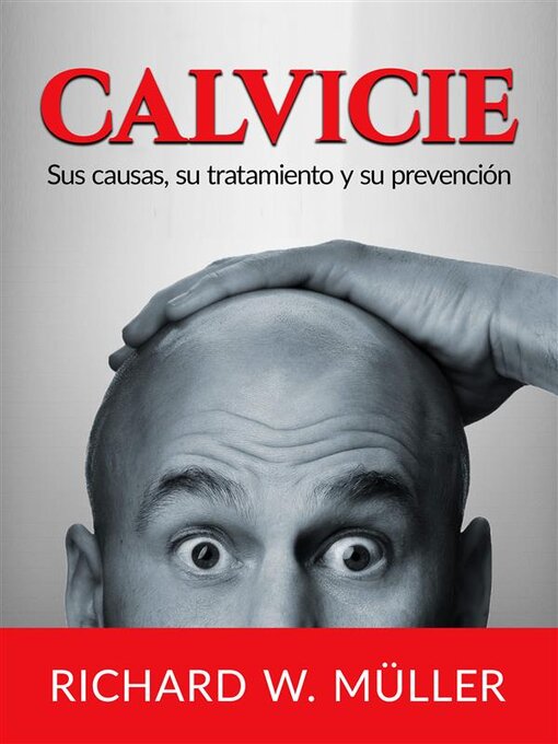 Cover image for Calvicie (Traducido)